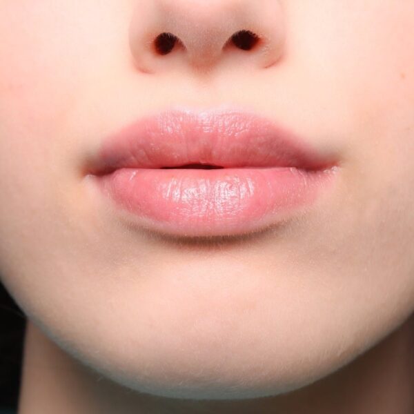 I can plump - Lip balm 15ml - Eterea | AltroStile