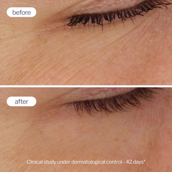 Pro-Retinolo - Doppio Siero Booster completo - Novexpert - immagine 3