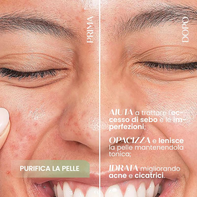 Siero Viso Purificante Astringente - Sensonaturale - immagine 2