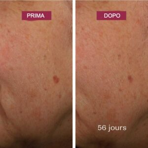 Siero Correttore Anti-Macchie Bio con Alghe e Vitamina C - Laboratoires de Biarritz