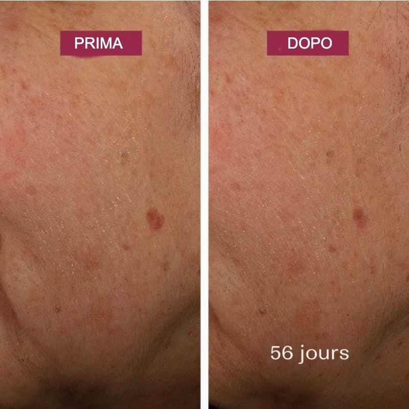 Siero Correttore Anti-Macchie Bio con Alghe e Vitamina C - Laboratoires de Biarritz - immagine 2