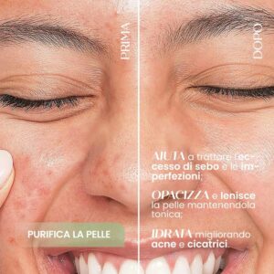 Siero Viso Purificante Astringente - Sensonaturale