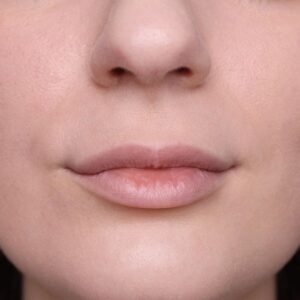 Collagen More Gloss Volumizzante - Skin Proof